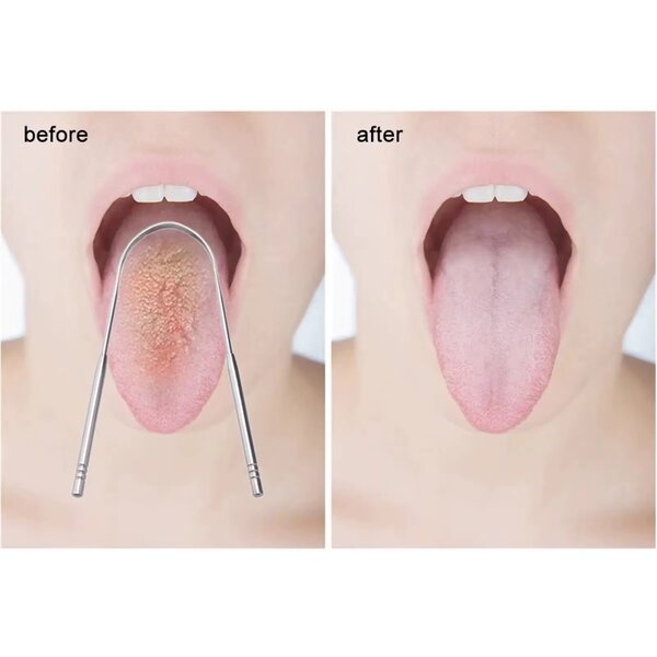 Gratte-langue en acier inoxydable