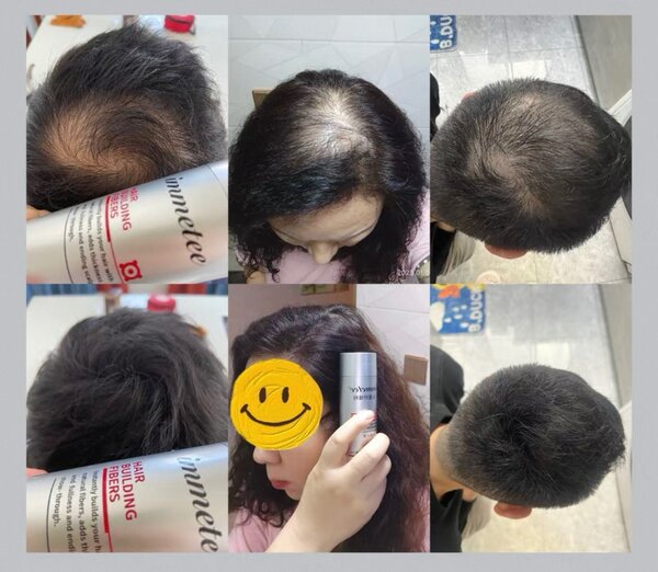 Immetee Fibres Capillaires