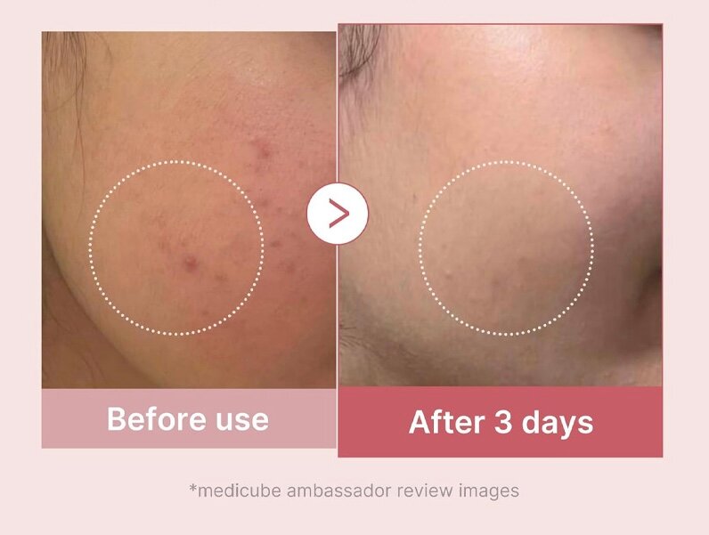 Medicube Niacinamide 5%