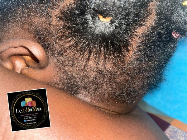 Serum capillaire pousse