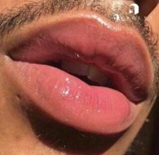 KITS pour lèvres rose