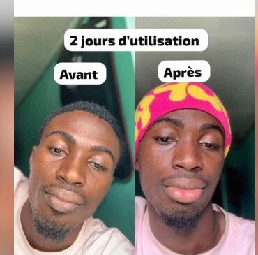 Baume à lèvres hydratant