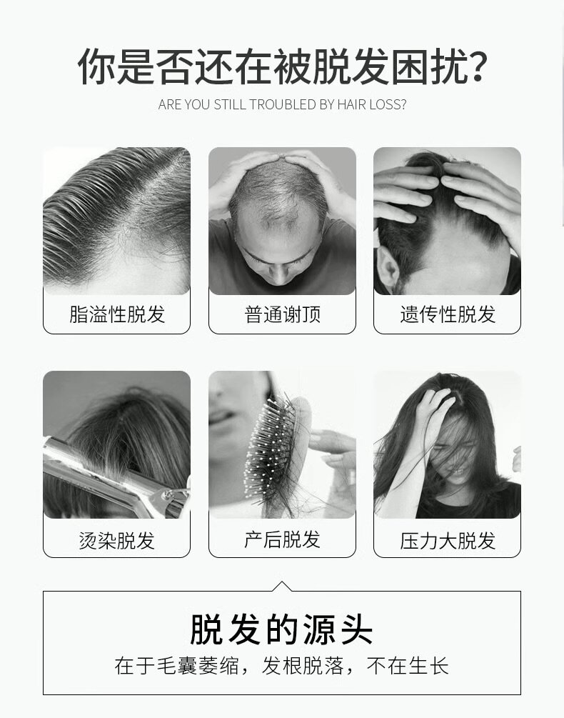 Спрей для роста волос. Спрей от алопеции