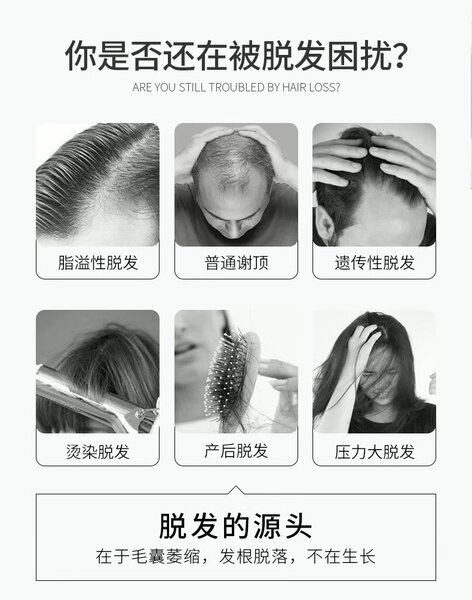 Спрей для роста волос. Спрей от алопеции