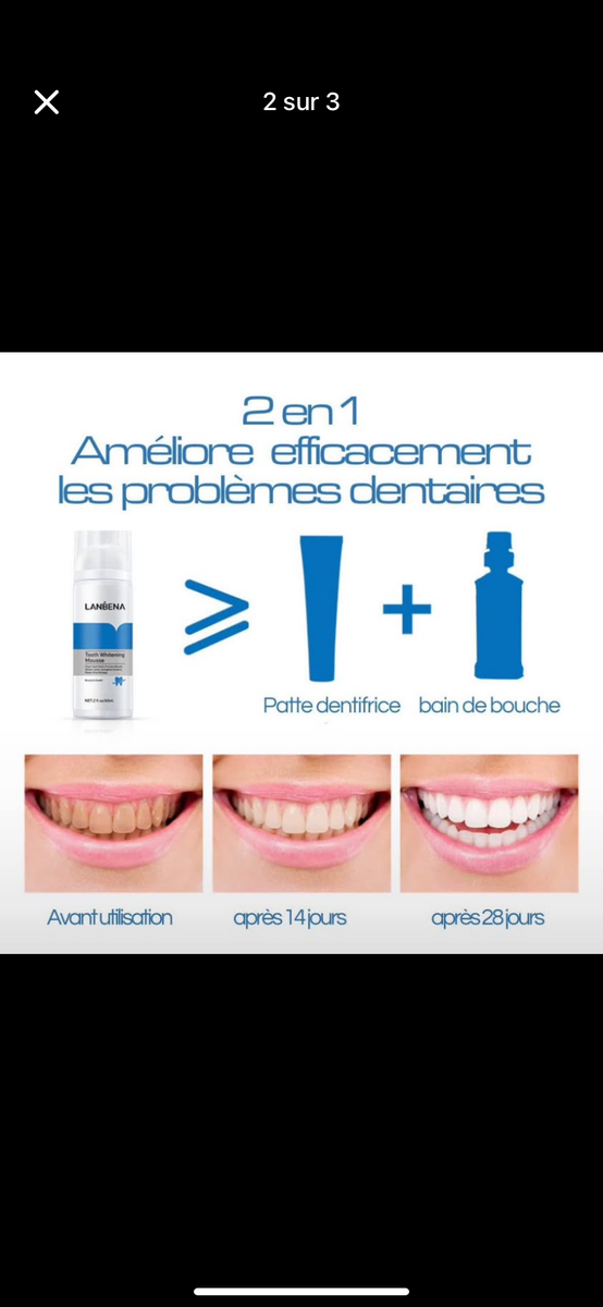 Mousse blanchissante dentaire