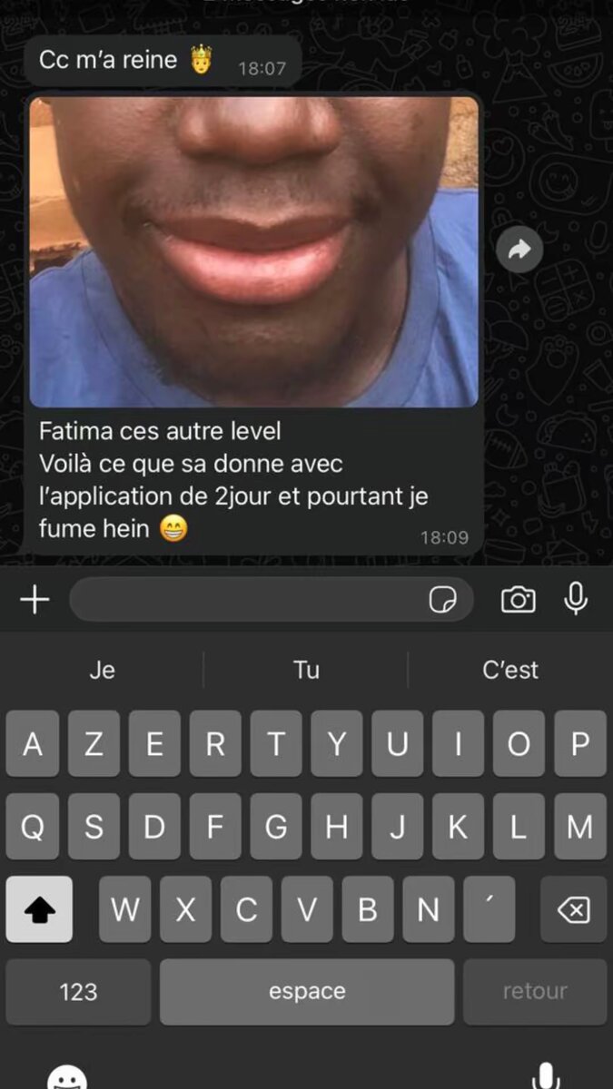 Soin  Lèvres