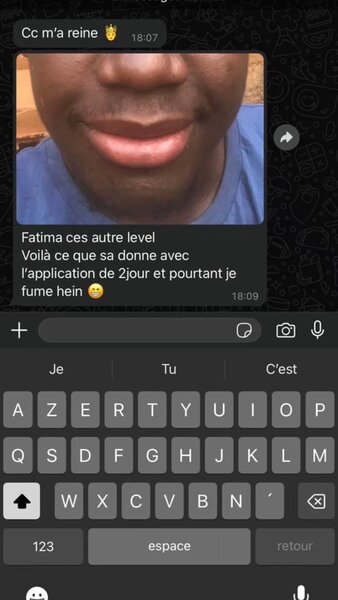 Soin  Lèvres