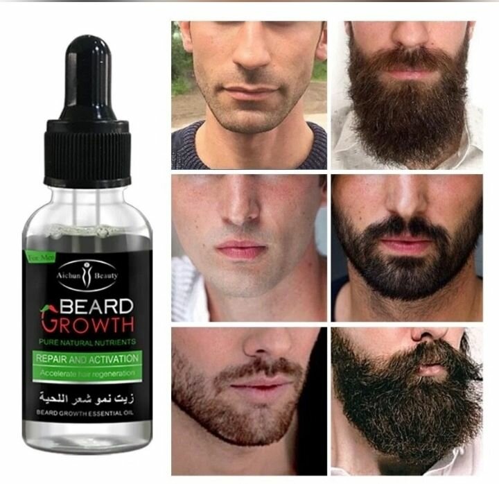 𝗙𝗶𝗻𝗶 𝗮𝘃𝗲𝗰 𝗹𝗮 𝗰𝗮𝗹𝘃𝗶𝘁𝗶𝗲 fait poussé la barbe