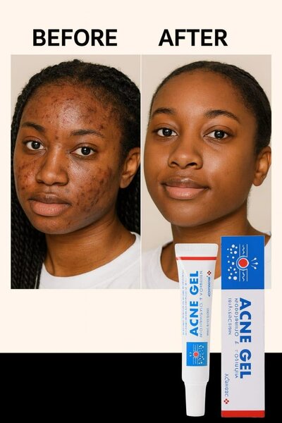 Crème visage