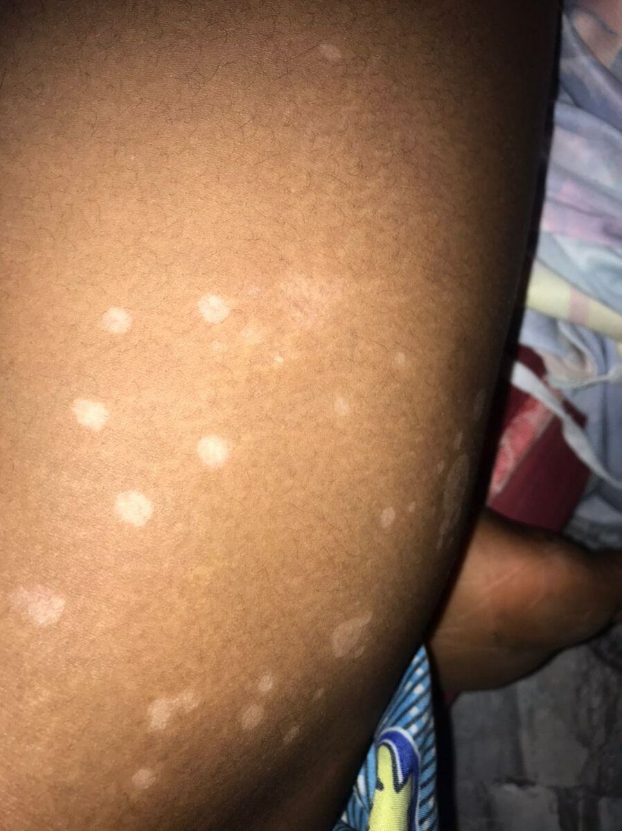 Crème Anti-Taches Blanche