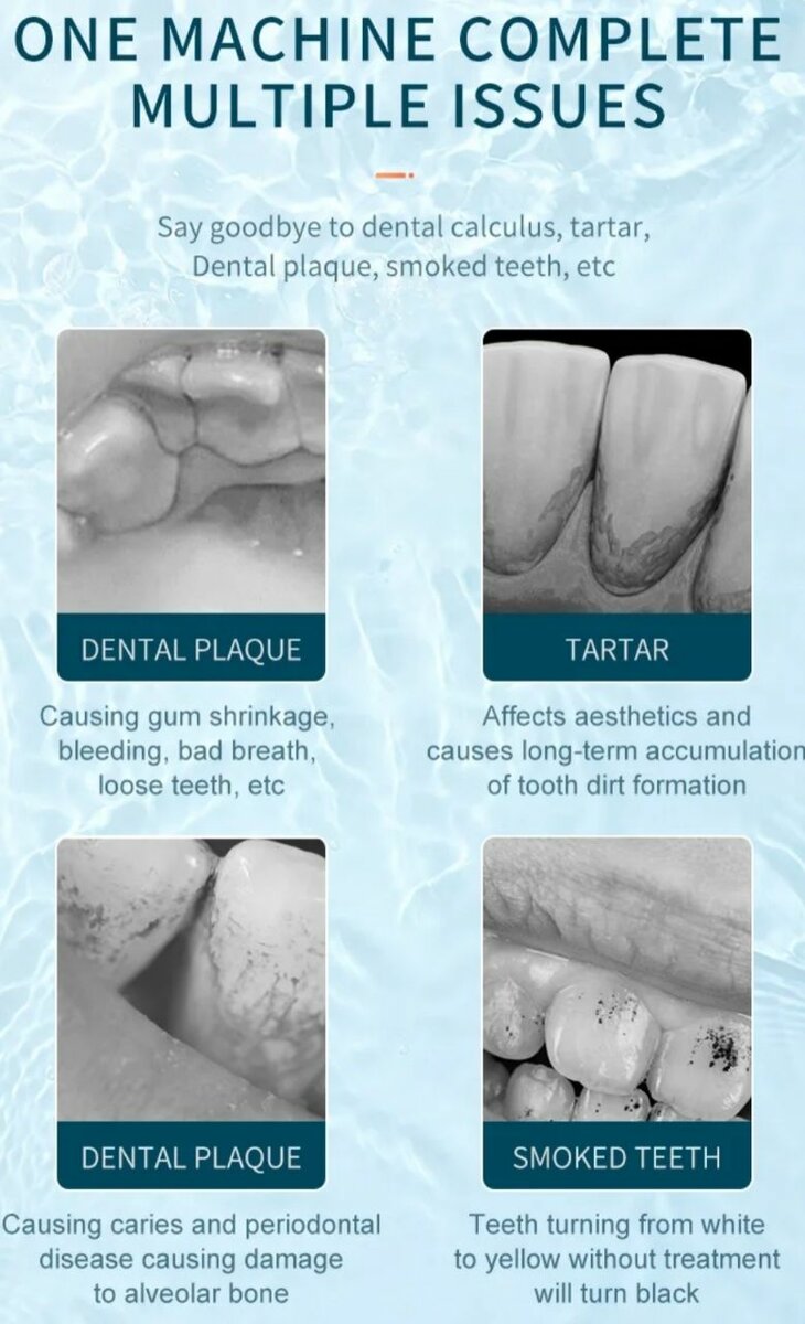 Détartrage Dentaire Électrique