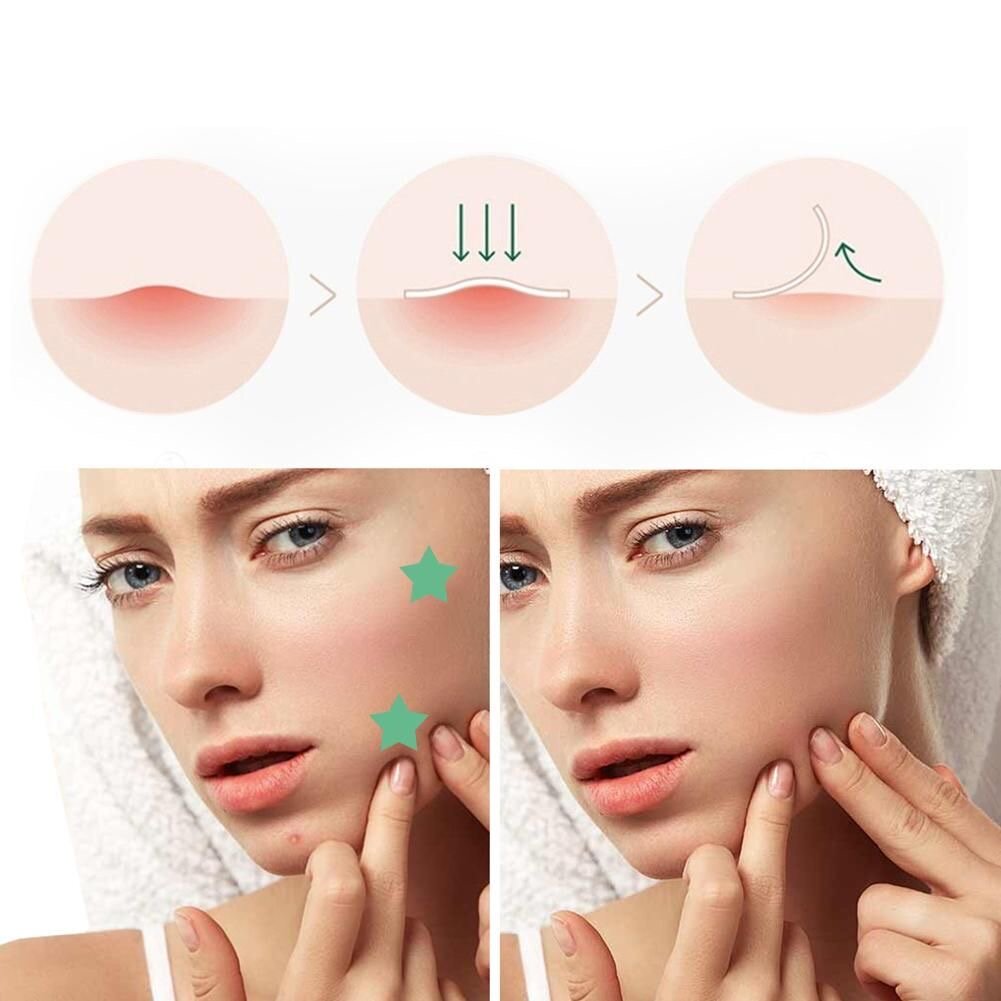 Patchs Étoiles Anti-Imperfections