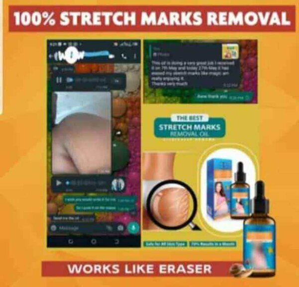 Stretch Marks removal Oil