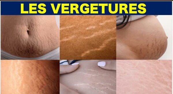 Savon noir anti-imperfections