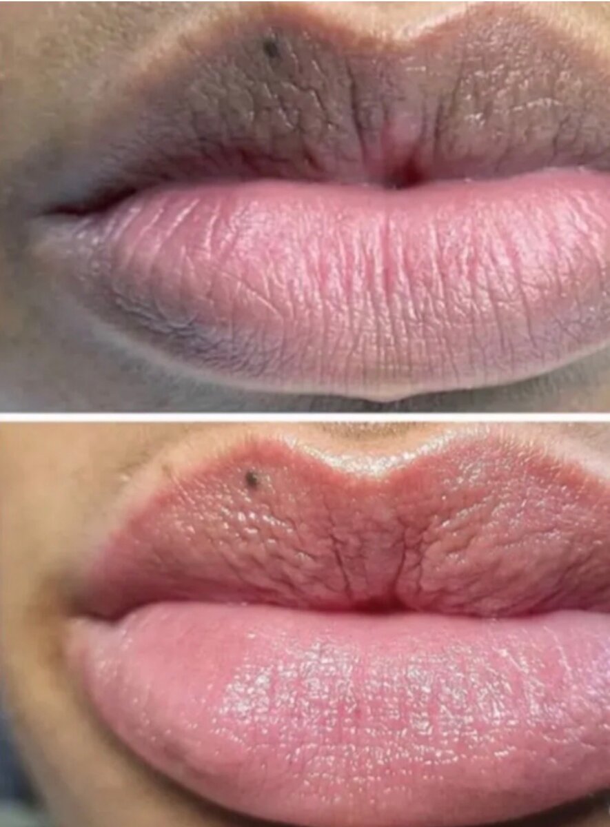 Crème lèvre rose efficace