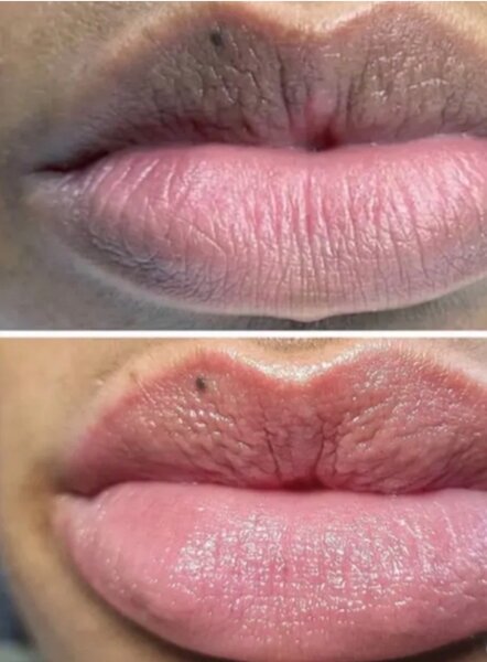 Crème lèvre rose efficace