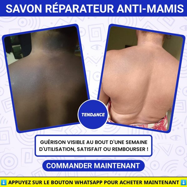Savon Réparateur Anti-Mamis