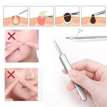 Outil d'extraction d'acné