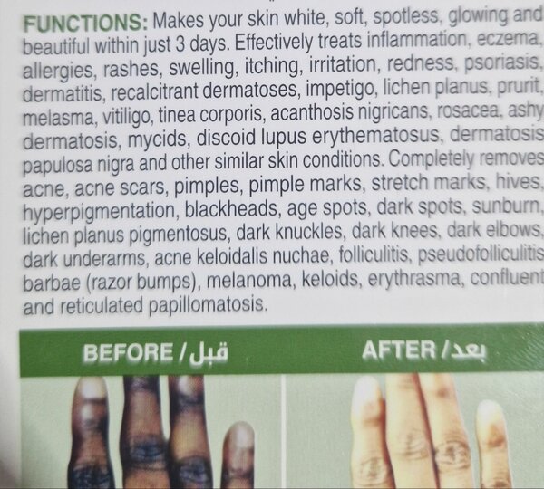 Crème contre les tâches