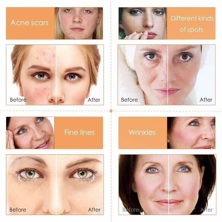 Sérum Visage Vitamine C Éclat