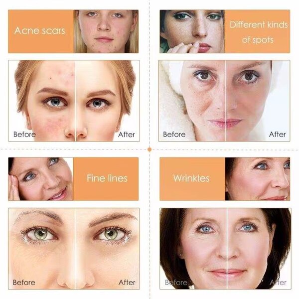 Sérum Visage Vitamine C Éclat