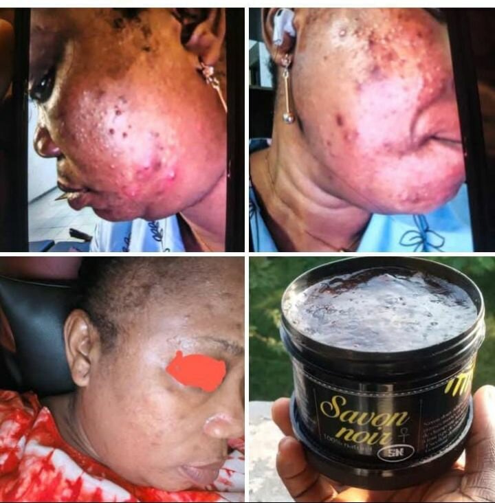 Kit soin peau hydratant