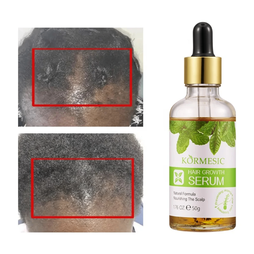 Sérum Croissance Cheveux Nourrissant