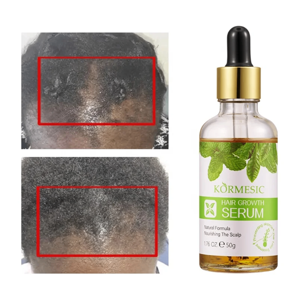 Sérum Croissance Cheveux Nourrissant