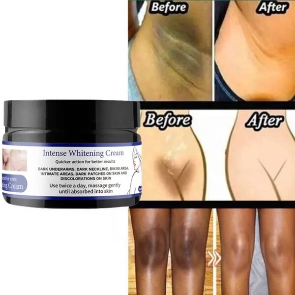 Crème Blanchissante Intense