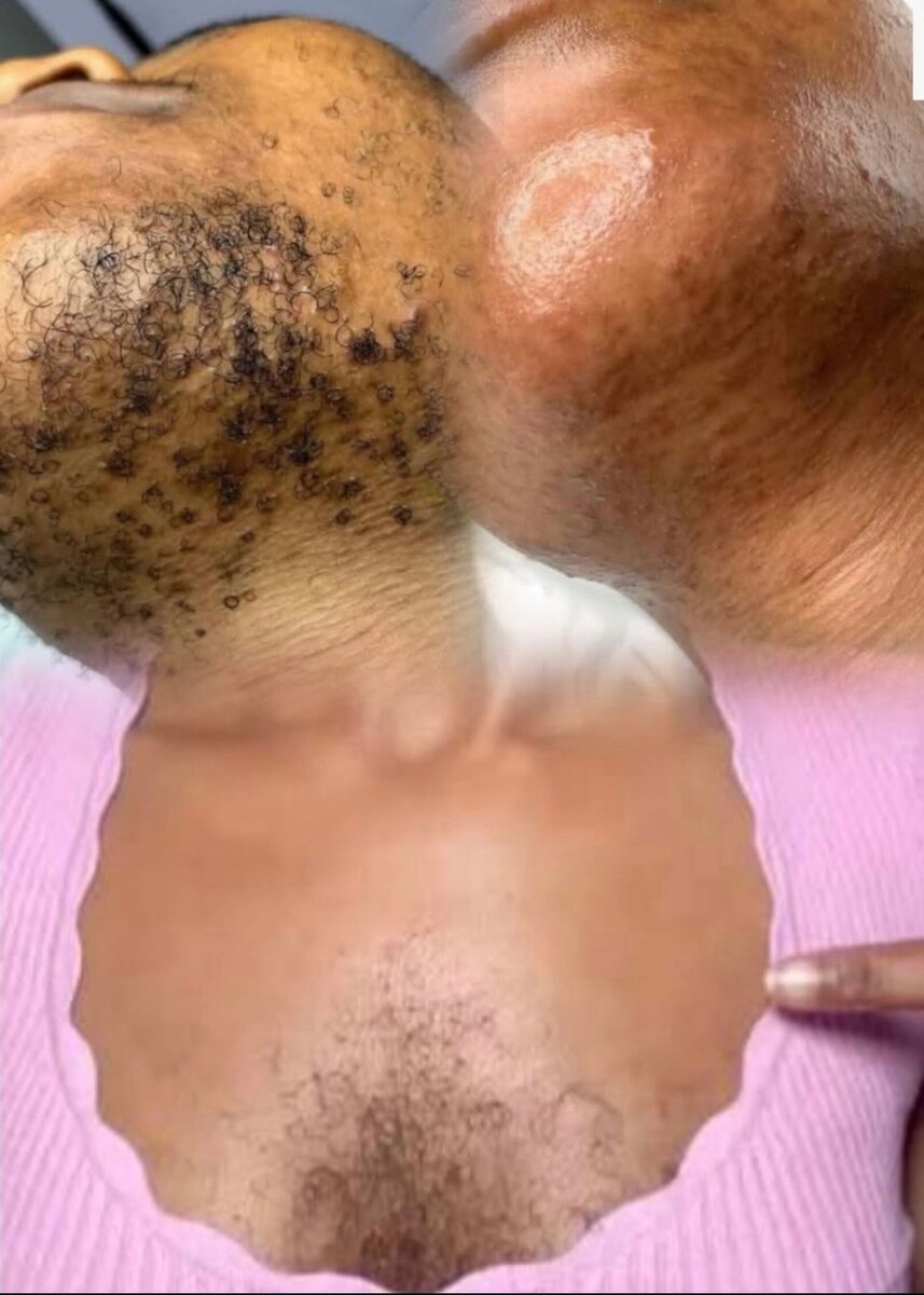 Hard Wax Beans pour épilation