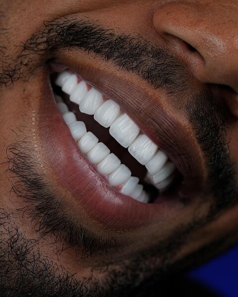 Dentifrice Blancheur Menthe