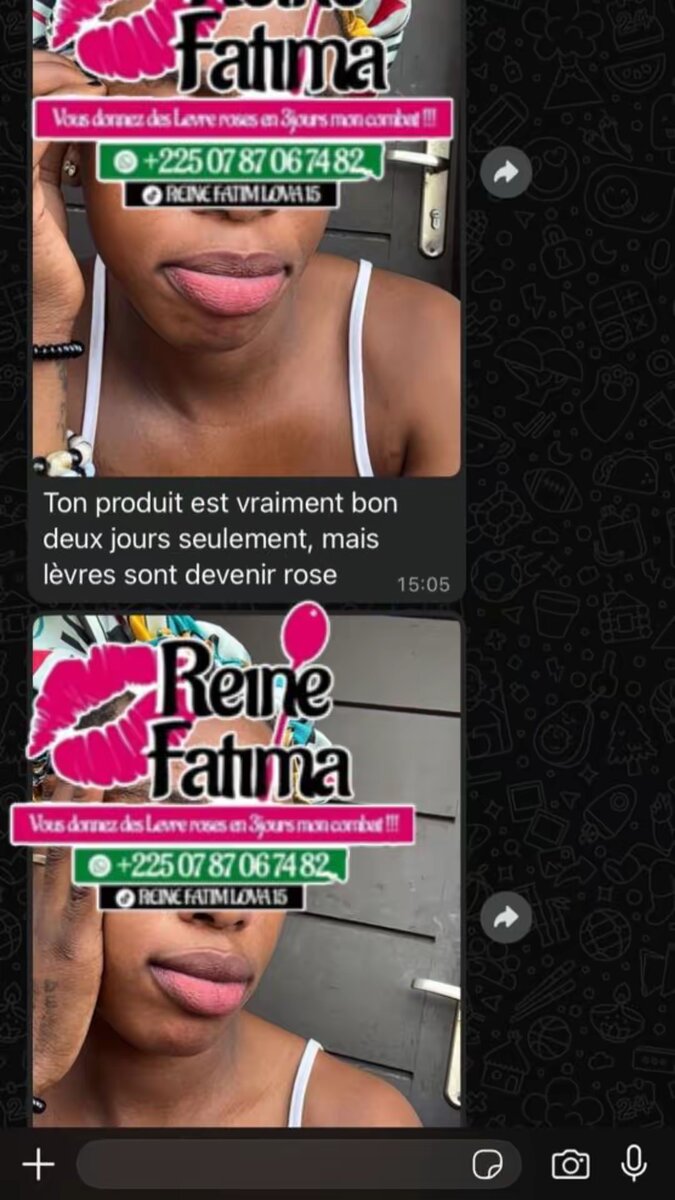 Kit Soin Lèvres Roses