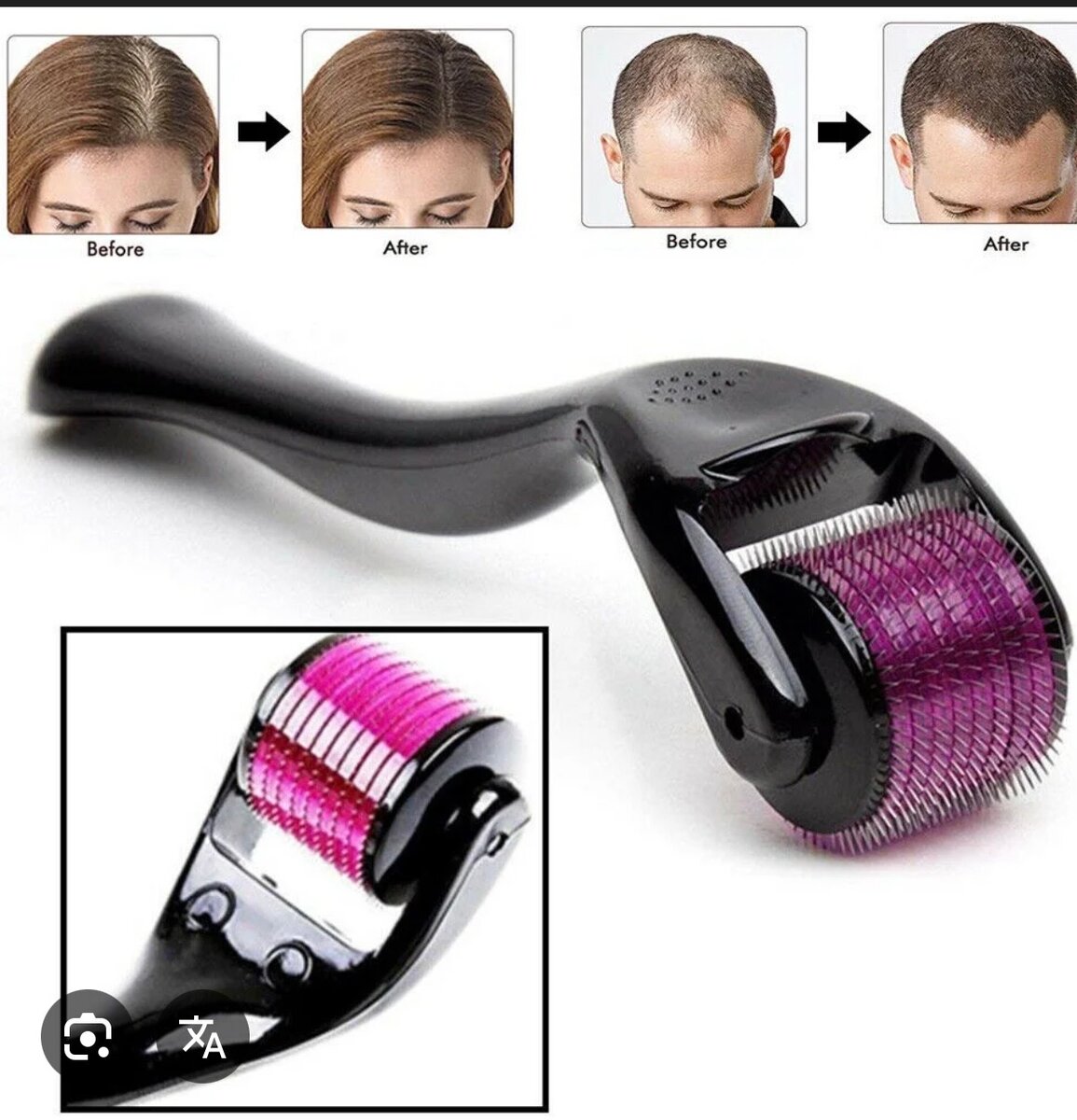 Derma Roller Micro Aiguilles