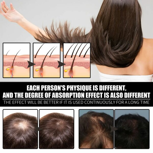 Huile de Biotine Antichute Cheveux