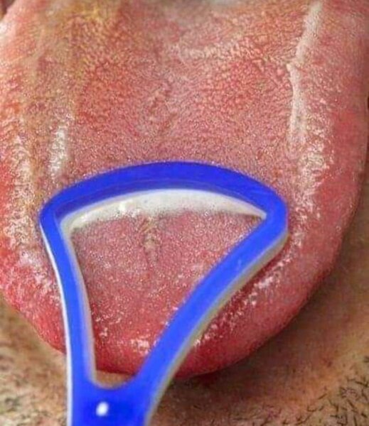 Gratte langue hygiénique