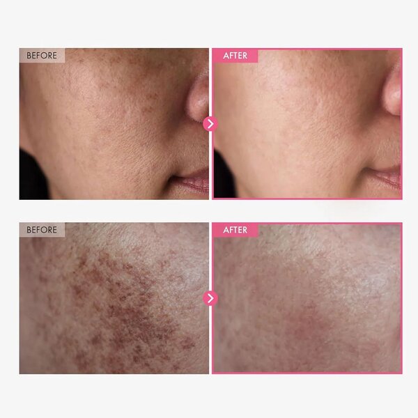 TOSOWOONG Arbutin 7% + Tranexamic Acid 4% Cream 50ml
