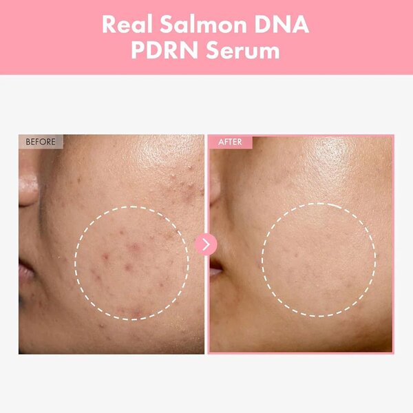 TOSOWOONG Pink Peptide 12 PDRN Serum 33ml