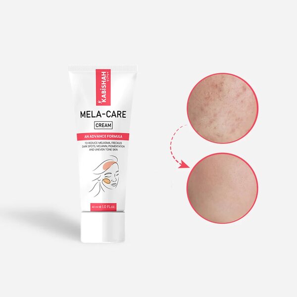 Mela Care Advanced Brightening Cream