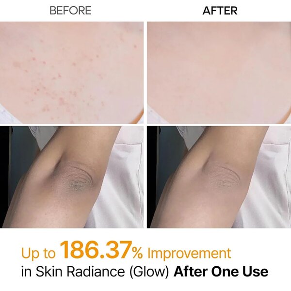 Dr.Melaxin Peel Shot Exfoliating Kojic Acid Turmeric Spray 200ml