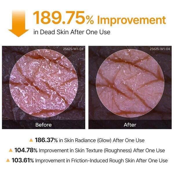 Dr.Melaxin Peel Shot Exfoliating Kojic Acid Turmeric Spray 200ml