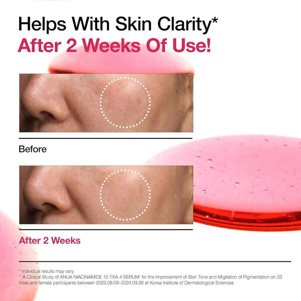 Anua Niacinamide 10% + TXA 4% Serum